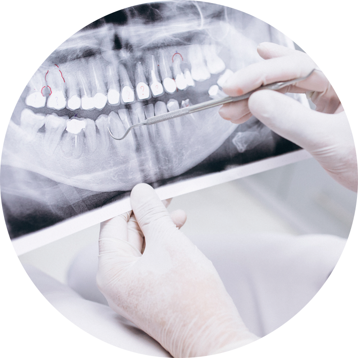 cirurgia-dentaria cirurgia dentaria