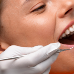 Limpeza Dental em Curitiba
