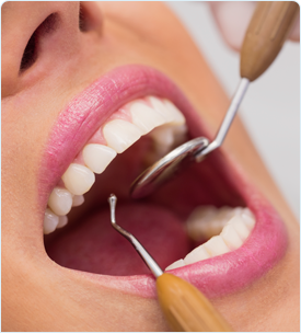 limpeza dental